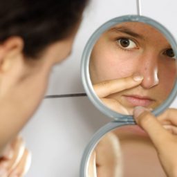 Quattro strategie efficaci per trattare l’acne